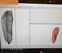 3D scanning af fod