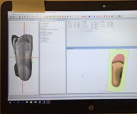 3D scanning af fod overført