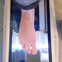 scanning af fod 2